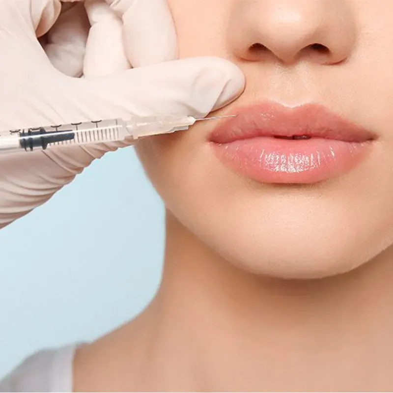 Dermal fillers