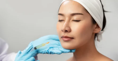 What is facial filler?